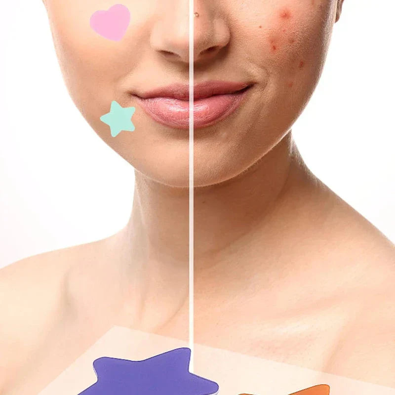 Colorful Hydrocolloid Acne Patches