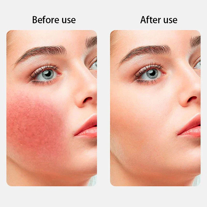 Reusable Silicone Ice Pack Hot Cold Therapy Gel Wrap