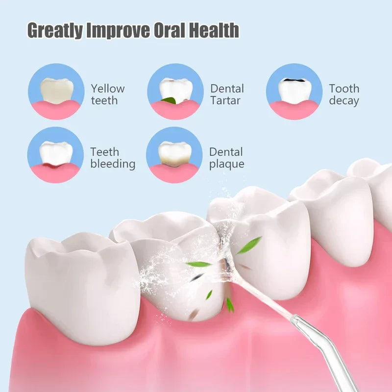 Water Flosser Oral Irrigator Tool