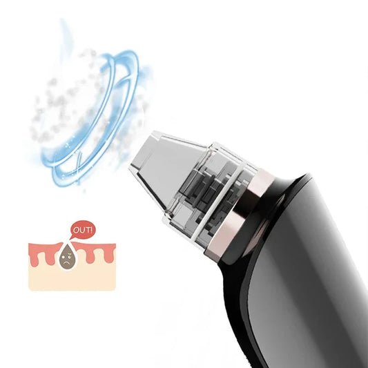 Smart Facial Pore Cleanser With Camera Display
